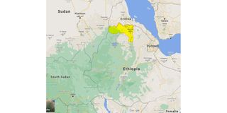Ethiopia.