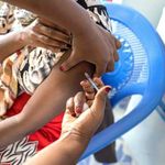  Vaccination