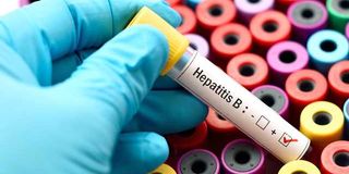Hepatitis B test.