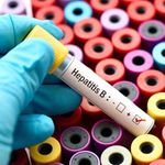 Hepatitis B test.